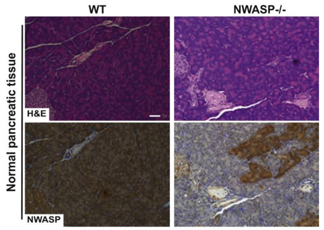 N-WASP antibody | knockout validation | Cell Signaling 4848 figure 1