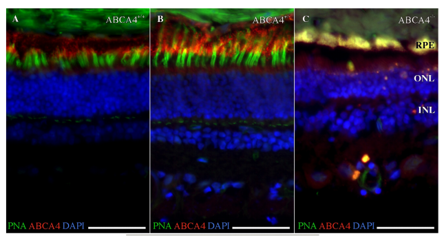 ABCA4 antibody | knockout validation | Novus Biologicals NBP1-30032 figure 1