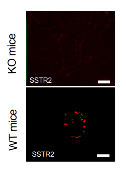 SSTR2 antibody | knockout validation | Santa Cruz sc-365502 figure 1