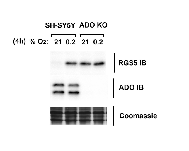 ADO antibody | knockout validation | Abcam ab134102 figure 1