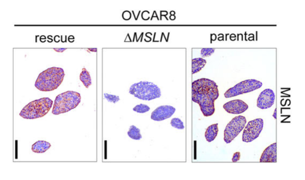 Mesothelin antibody | knockout validation | Thermo Fisher MA5-16378 figure 1