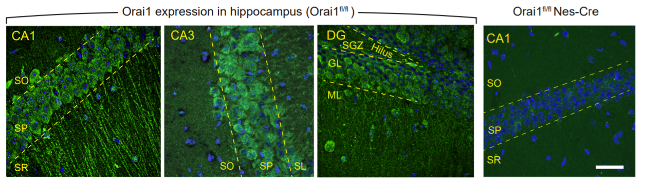 Orai1 antibody | knockout validation | Abcam ab175040 figure 1