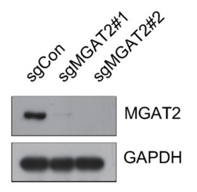 MGAT2 antibody | knockout validation | Abcam ab184965 figure 1
