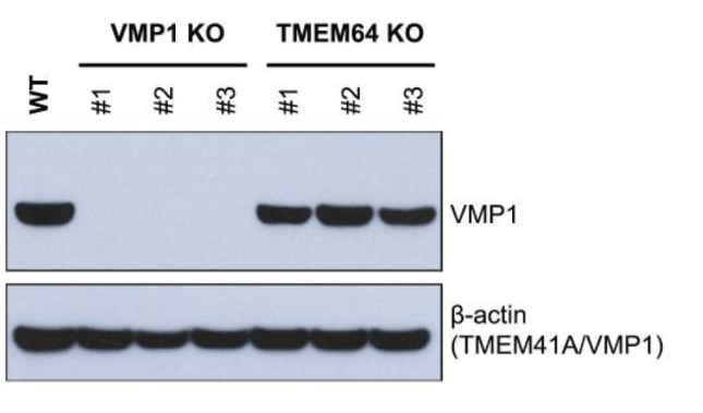 TMEM49/VMP1 antibody | knockout validation | Cell Signaling 12929 figure 1