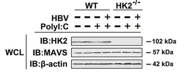 Hexokinase II antibody | knockout validation | Abcam ab104836 figure 1