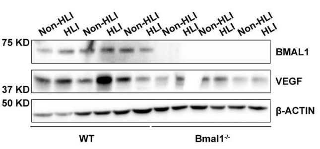 BMAL1 antibody | knockout validation | Cell Signaling 14020 figure 1