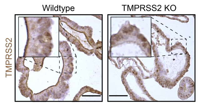 TMPRSS2 antibody | knockout validation | Abcam ab109131 figure 1