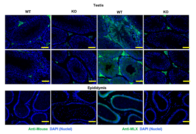 MLX antibody | knockout validation | Cell Signaling 85570 figure 1