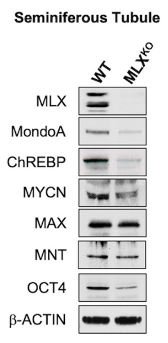 MLX antibody | knockout validation | Cell Signaling 85570 figure 2