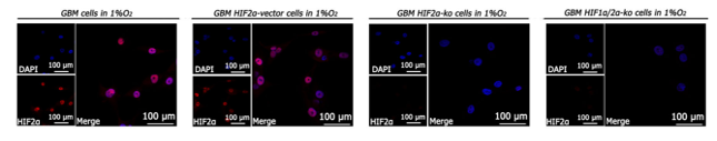 HIF-2-alpha antibody | knockout validation | Abcam ab207607 figure 1