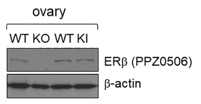 Estrogen Receptor Beta antibody | knockout validation | Thermo Fisher MA5-24807 figure 1