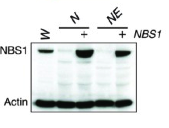 Nbs1 rabbit polyclonal antibodies from Novus Bio NB100-143  and Bethyl A301-284A  were validated in knockout mice figure 2