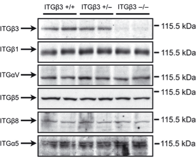 Cell Signaling Technology polyclonal  anti integrin b3 antibody was validated in knockout mice figure 1