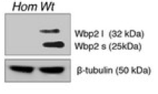 Wbp2  antibody | knockout validation | Cell Signaling 11831 figure 1