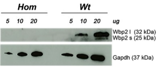 Wbp2  antibody | knockout validation | Cell Signaling 11831 figure 2