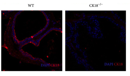 CK18  antibody | knockout validation | Epitomics 3258-1 figure 1