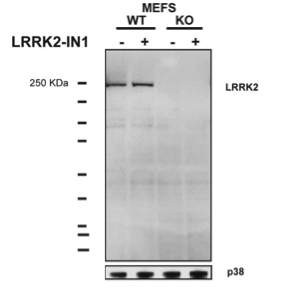 LRRK2  antibody | knockout validation | Epitomics 5097-1 figure 1