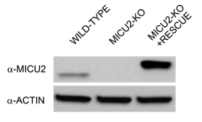MICU2 antibody | knockout validation | Abcam ab101465 figure 1