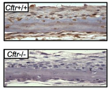 CFTR antibody | knockout validation | Cystic Fibrosis Folding Consortium 3G11 figure 1