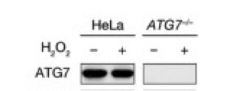 ATG7 | knockout validation | MBL PM039 figure 1