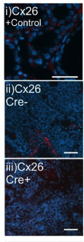 Cx26 antibody | knockout validation | Invitrogen 13-8100 figure 1