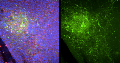Optogenetics figure 6