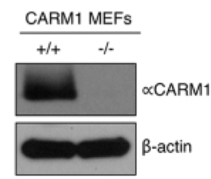 CARM1 antibody | knockout validation | Bethyl Laboratories A300-421A figure 1