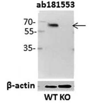 IRF5 antibody | knockout validation | Abcam ab181553 figure 1
