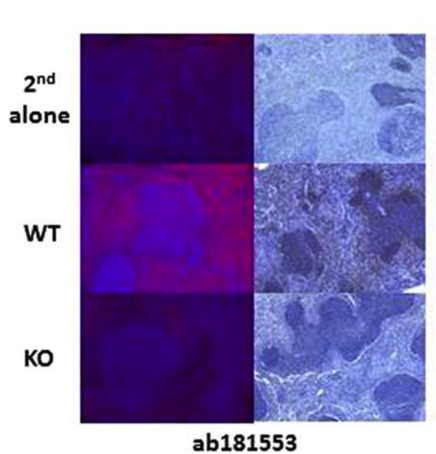 IRF5 antibody | knockout validation | Abcam ab181553 figure 2