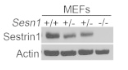 Sestrin1 antibody | knockout validation | Santa Cruz Biotechnology sc-376170 figure 1