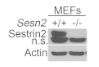 Sestrin2 antibody | knockout validation | ProteinTech 10795-1-AP figure 1