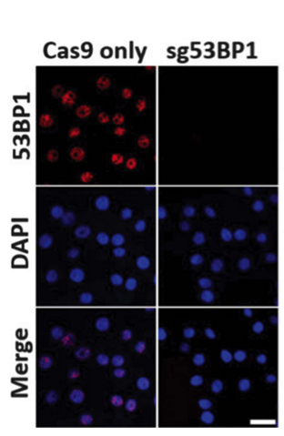 53BP1 antibody | knockout validation | Novus NB100-304 figure 1