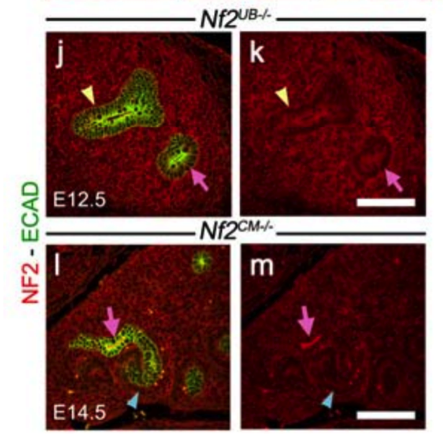 NF2 antibody | knockout validation | Sigma HPA003097 figure 1