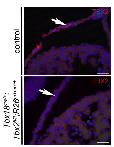 TBX2 antibody | knockout validation | Millipore 07-318 figure 1