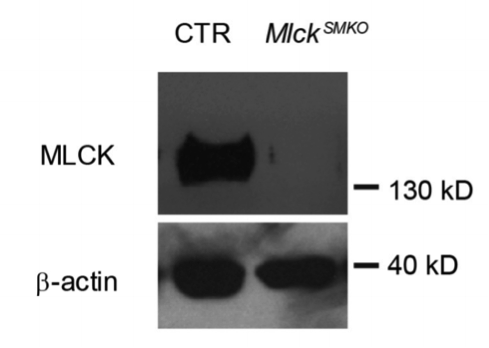 Myosin Light Chain Kinase antibody | knockout validation | Sigma M7905  figure 1