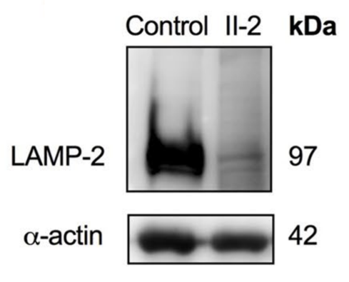 LAMP-2/CD107b antibody | knockout validation | Novus Biologicals NBP2-22217 figure 1