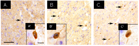 Parkinson's Disease Animal Models figure 1