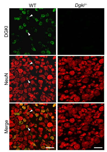 DGK-iota antibody | knockout validation | R&D Systems MAB6435 figure 1