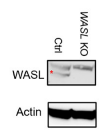 N WASP antibody | knockout validation | Abcam ab126626 figure 1