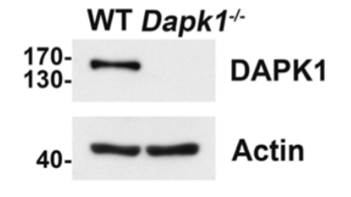 Death Associated Protein Kinase antibody | knockout validation | Sigma D2178 figure 1